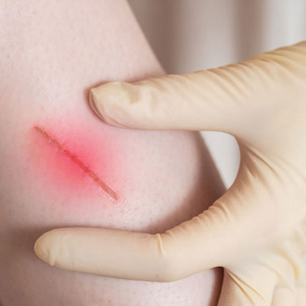 Wound Panel